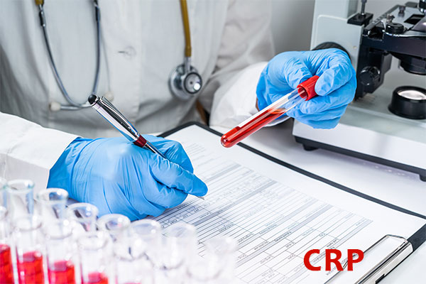 C-reactive protein CRP